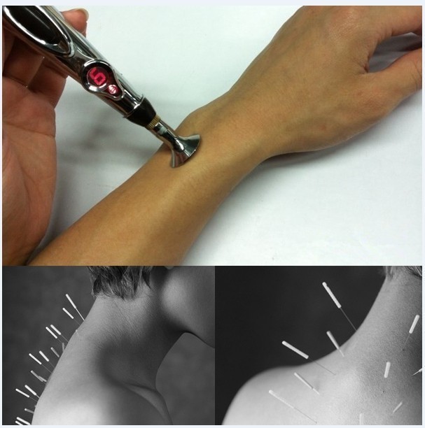 Case study Acupuncture Pen